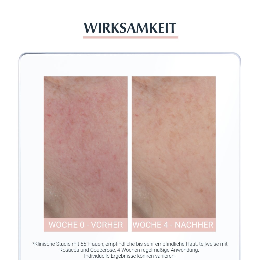 EUCERIN SEH Anti-Rötungen beruhigende Pflege