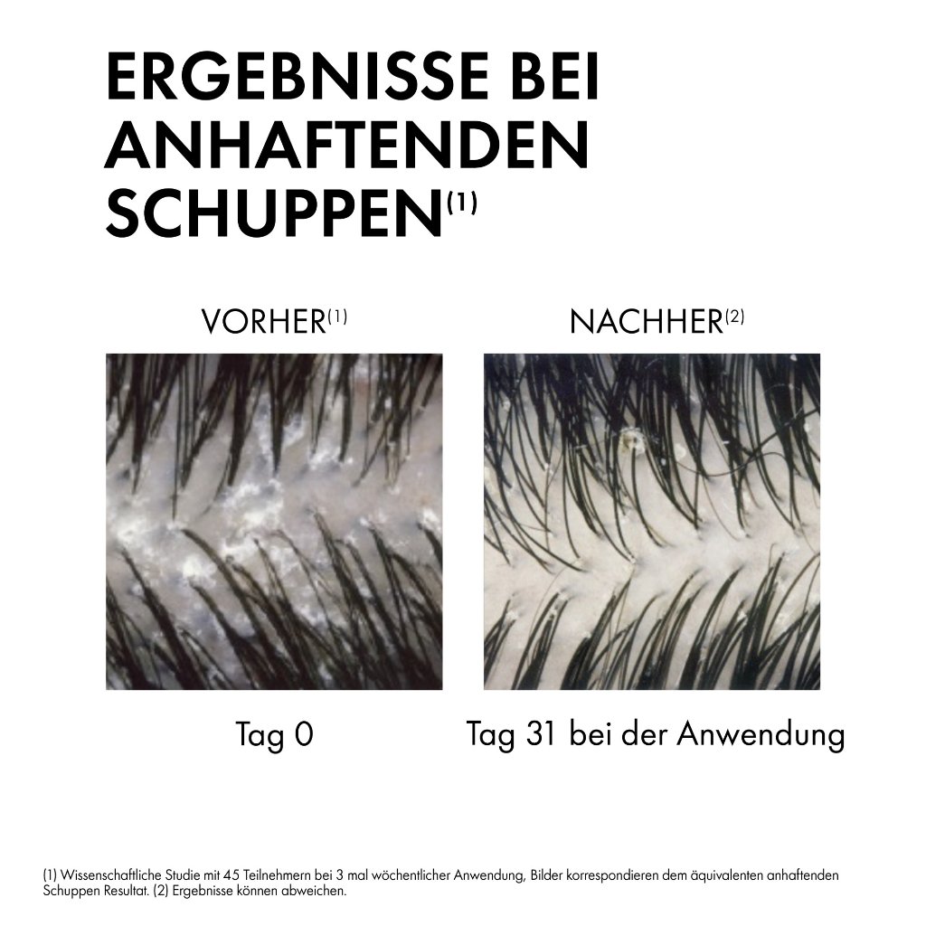 Vichy Dercos Anti-Schuppen Shampoo trockene Kopfhaut