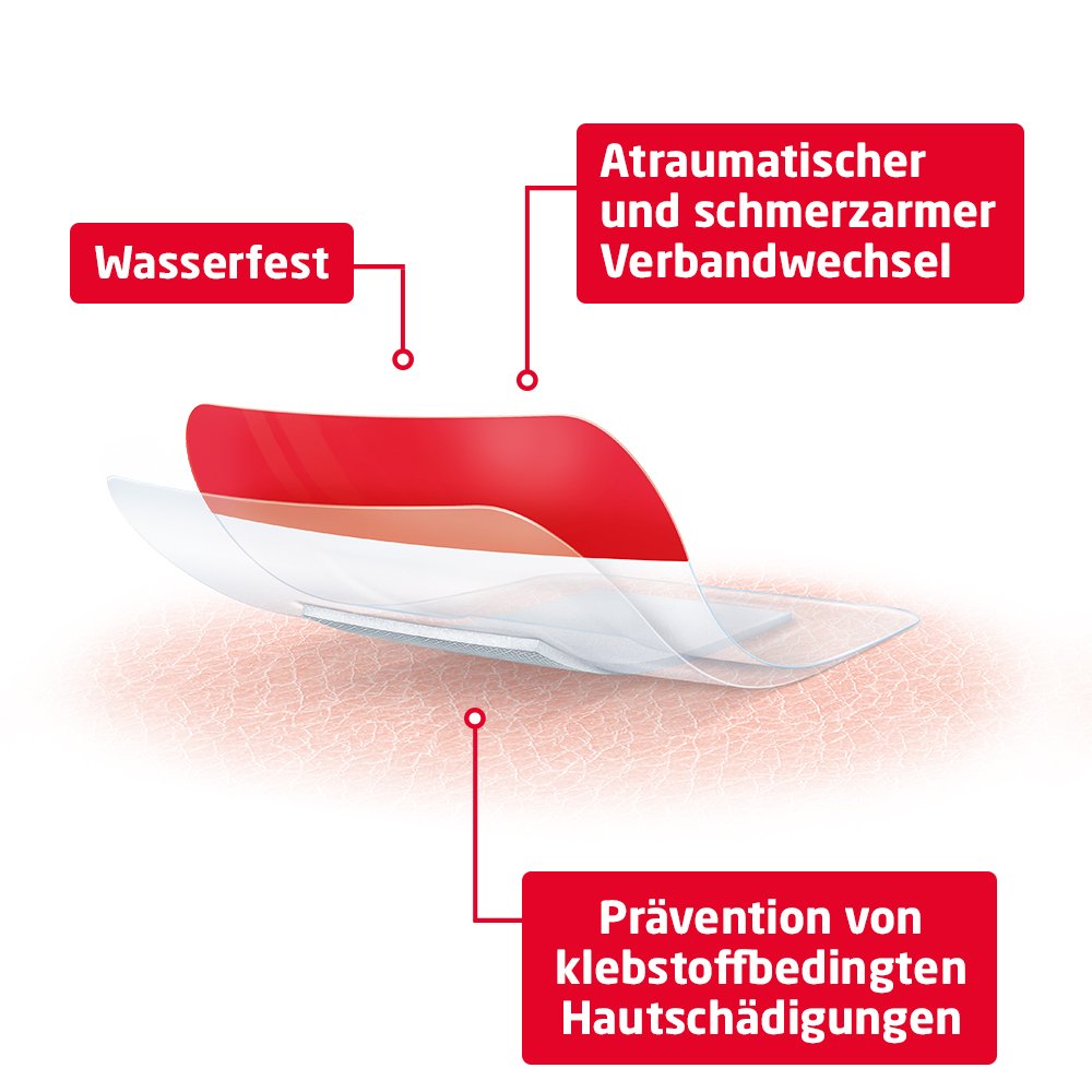 LEUKOMED T plus skin sensitive steril 8x10 cm
