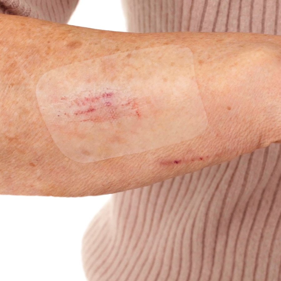 LEUKOMED T skin sensitive steril 5x7,2 cm