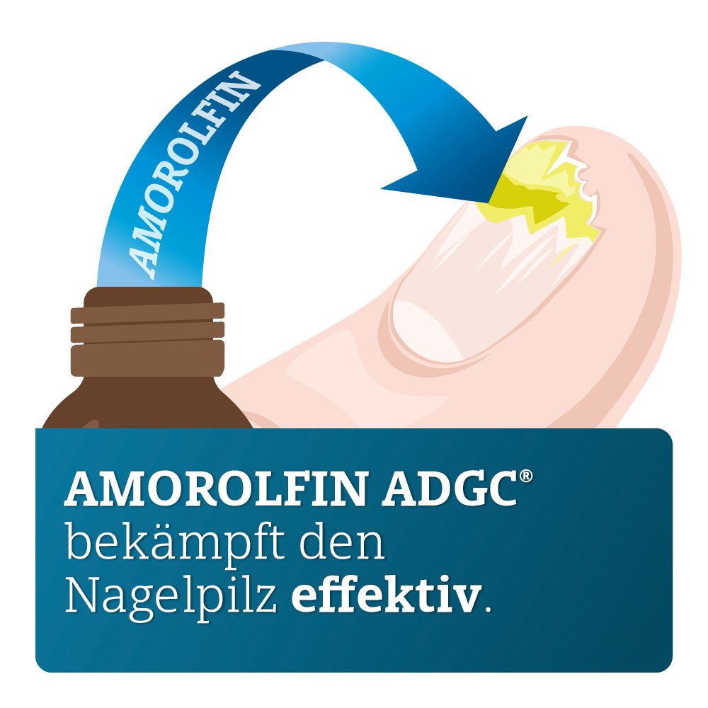 AMOROLFIN ADGC 50 mg/ml wirkstoffhalt.Nagellack
