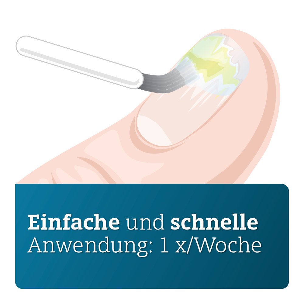 AMOROLFIN ADGC 50 mg/ml wirkstoffhalt.Nagellack