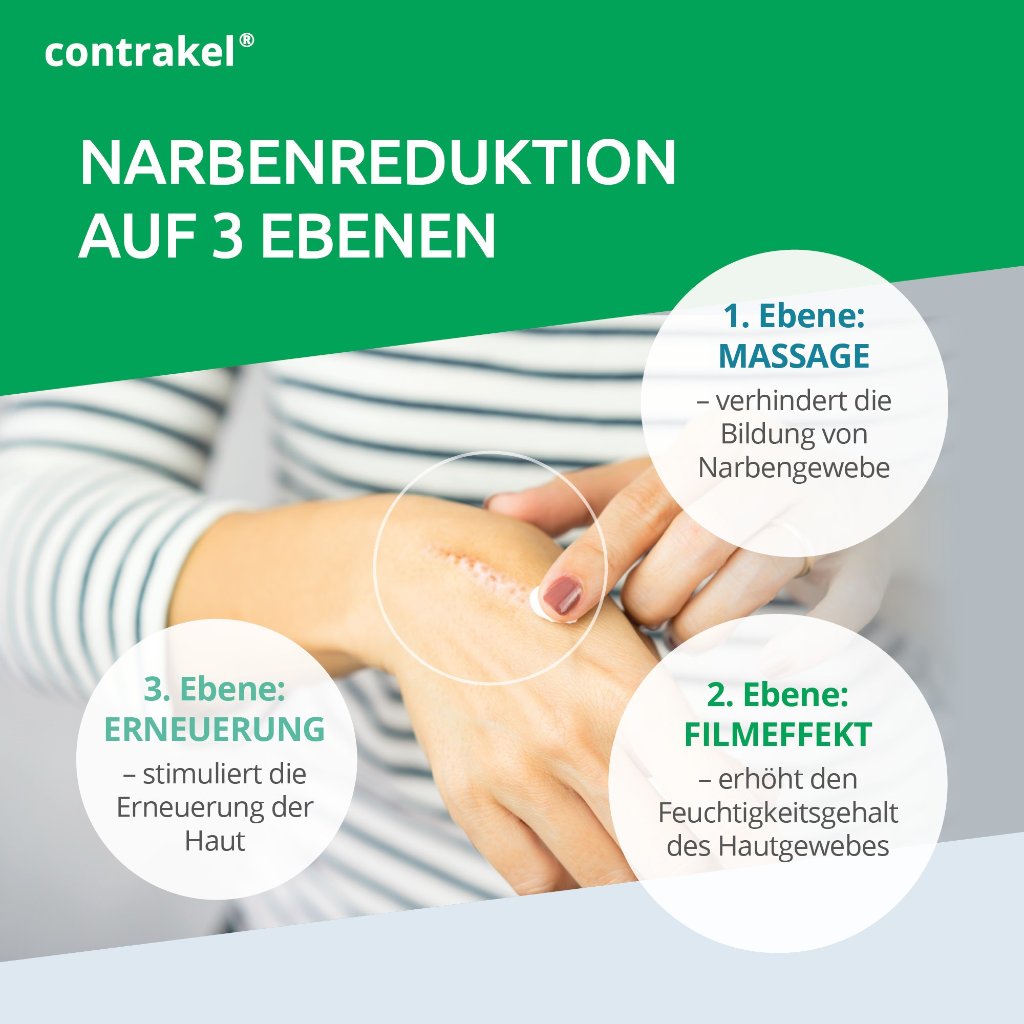 CONTRAKEL Narbencreme mit Kelosun Sonnenschutz