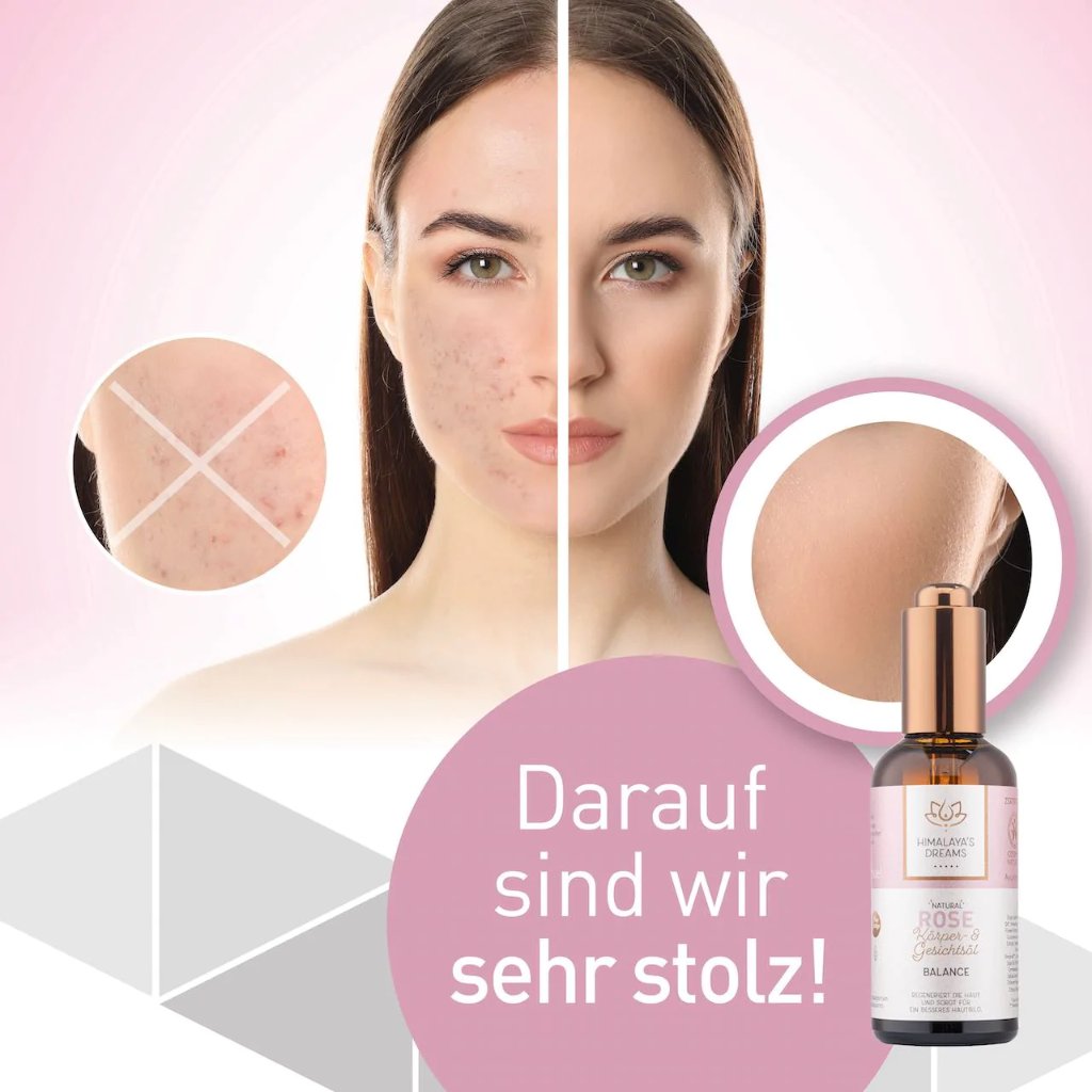 HIMALAYA'S Dreams Ayurveda Körper&Gesichtsöl Rose