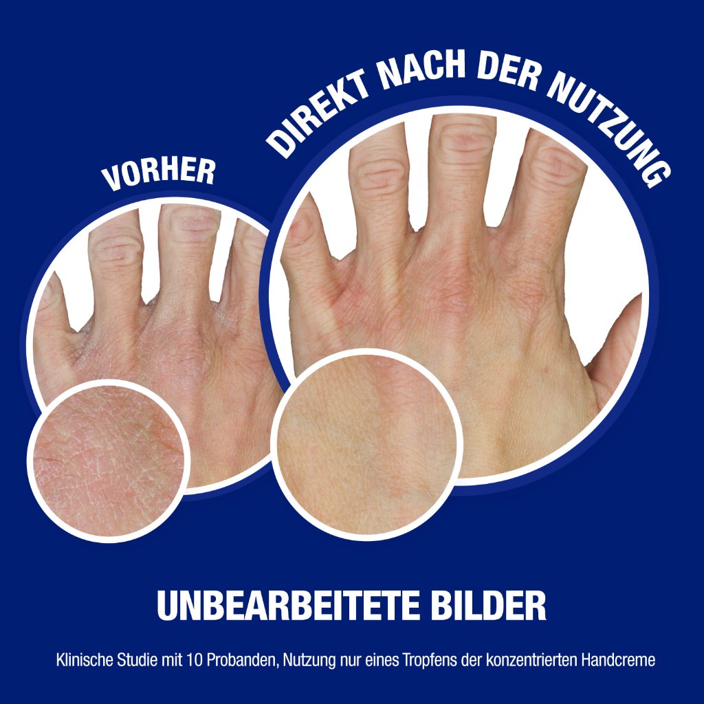 Neutrogena Norwegische Formel Sofort Einziehende Handcreme