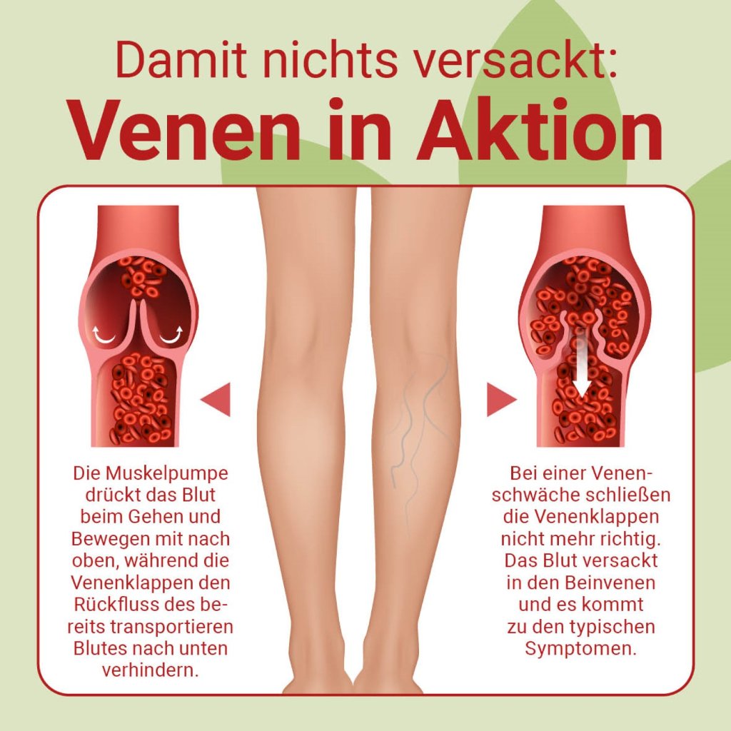 VENOX 45 mg Weichkapseln