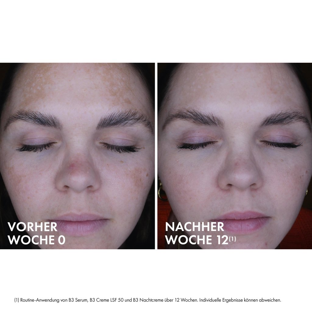 Liftactiv B3 Retinol Nachtcreme