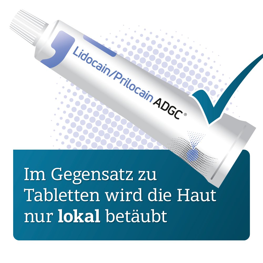 LIDOCAIN/PRILOCAIN ADGC 25 mg/g + 25 mg/g Creme