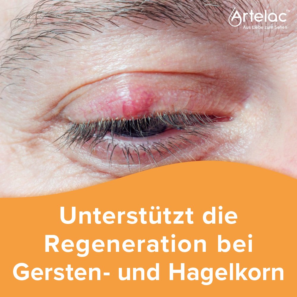 Artelac™ Augenlidhelfer