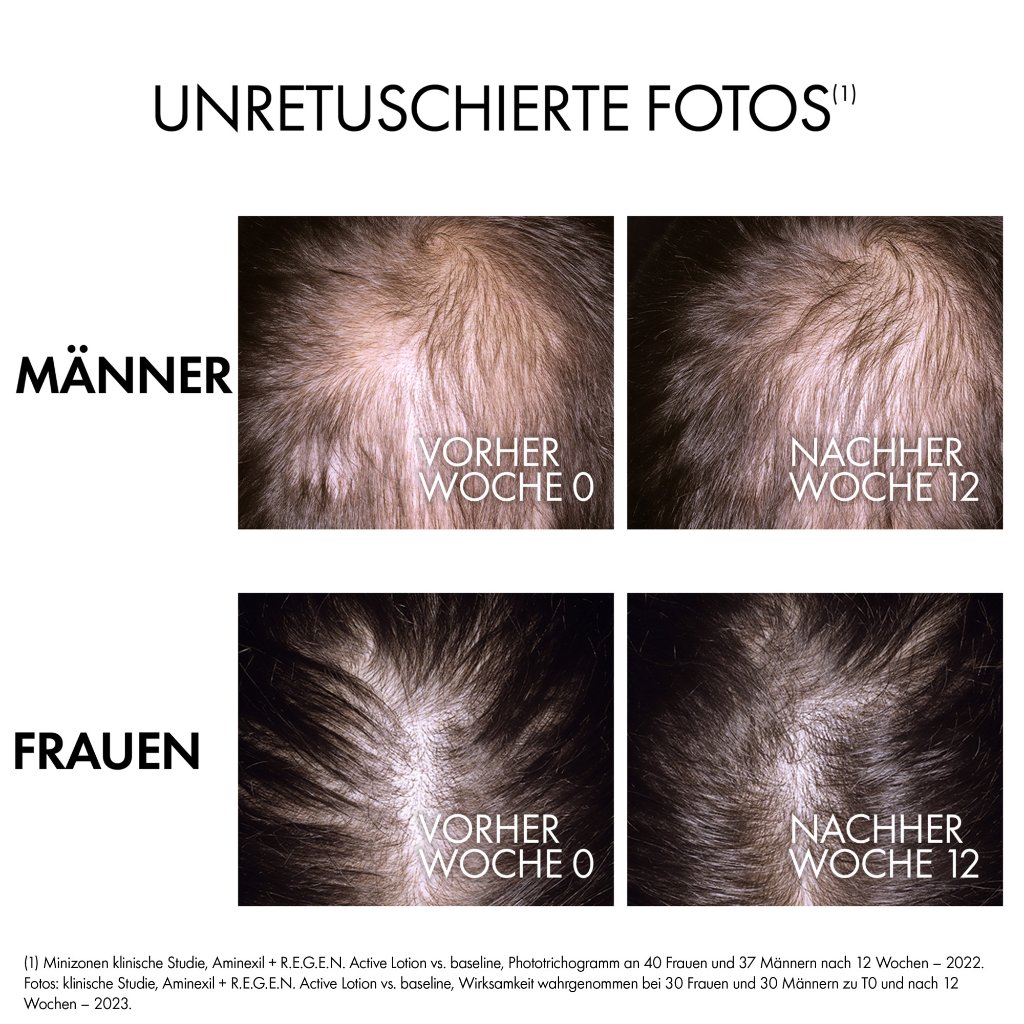 Vichy Dercos R.E.G.E.N. Booster Anti-Haarverlust