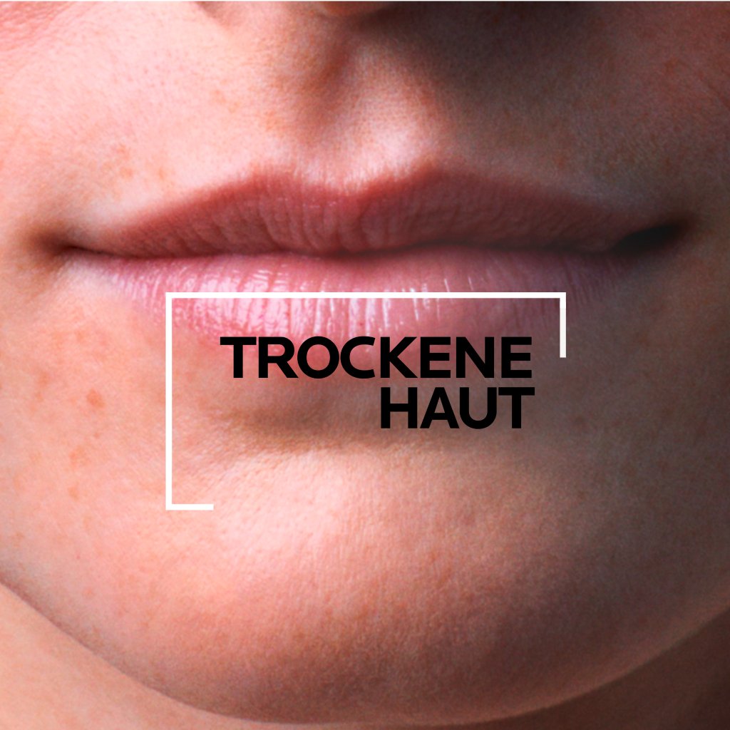 Nutritic Lippen
