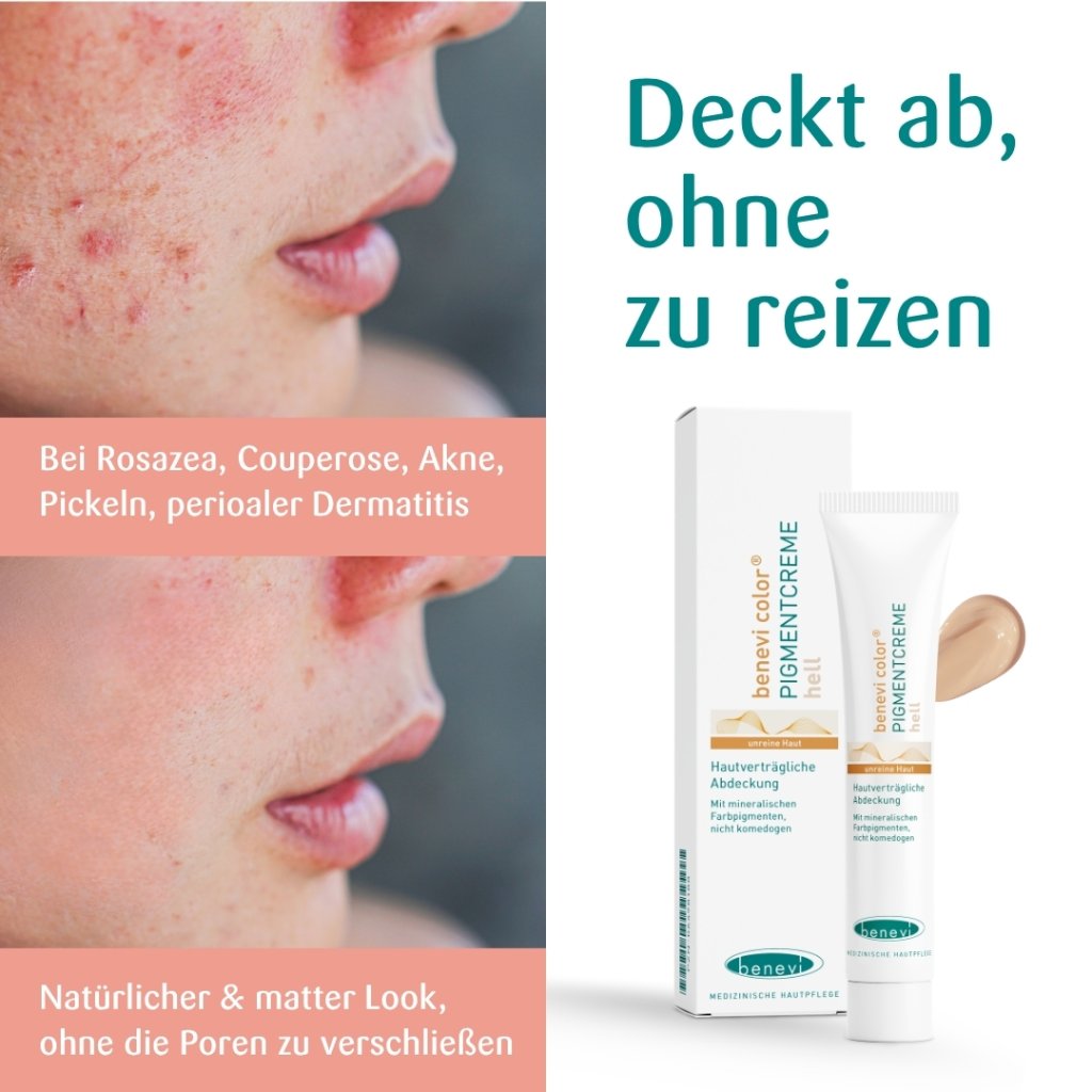 BENEVI Color Pigmentcreme hell